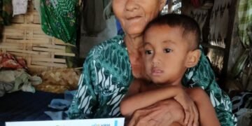 Anak Penderita Gizi Buruk