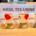 Komitmen Zero Narkoba, Lapas Bandanaira Rutin Tes Urine Warga Binaan dan Petugas 18 WhatsApp Image 2026 09 15 at 07.17.42